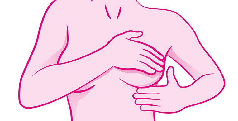 a) Un bulto o masa en el seno o la axila.