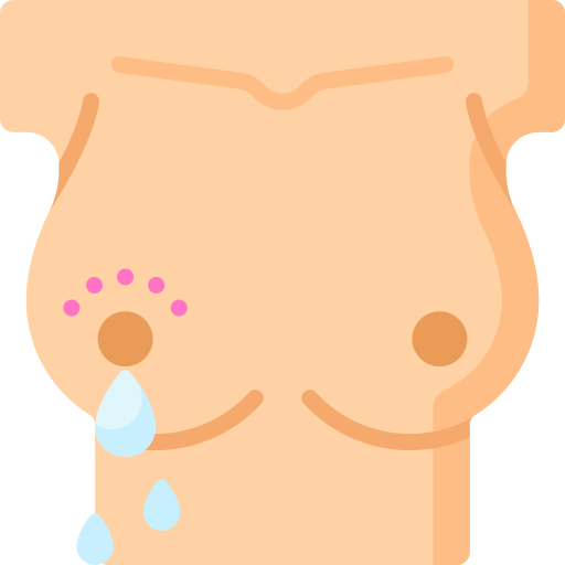 b) Secreción inusual del pezón (especialmente con sangre).